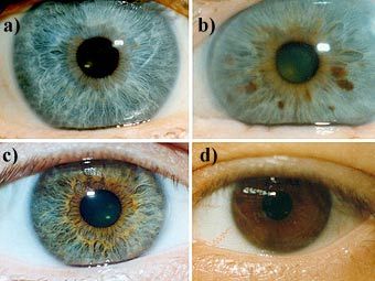 ��������� �������� ����� ����. a) ������� (���������� ��������) b) ������� � ������������ ������ c) ������-����� d) �����