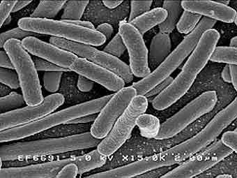 �������� ������� Escherichia coli. ���� Rocky Mountain Laboratories, NIAID, NIH
